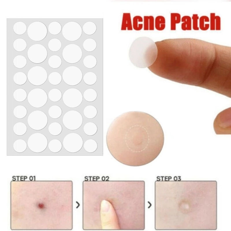 🍓Miếng dán Hỗ trợ giảm mụn Star Hydrocolloid để che vết thâm và vết thâm, Miếng dán vết thâm vô hình, Miếng dán vết thâm