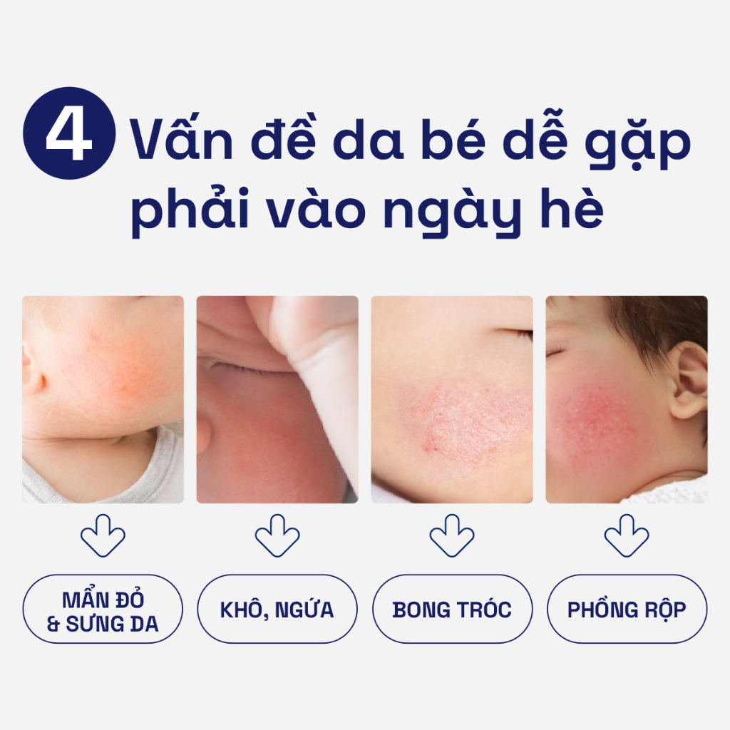 Combo dự sinh 3 bước chăm sóc da bé toàn diện Dầu Massage 200ML + Sữa tắm gội 230ML + Kem dưỡng ẩm 100G Cetaphil Baby
