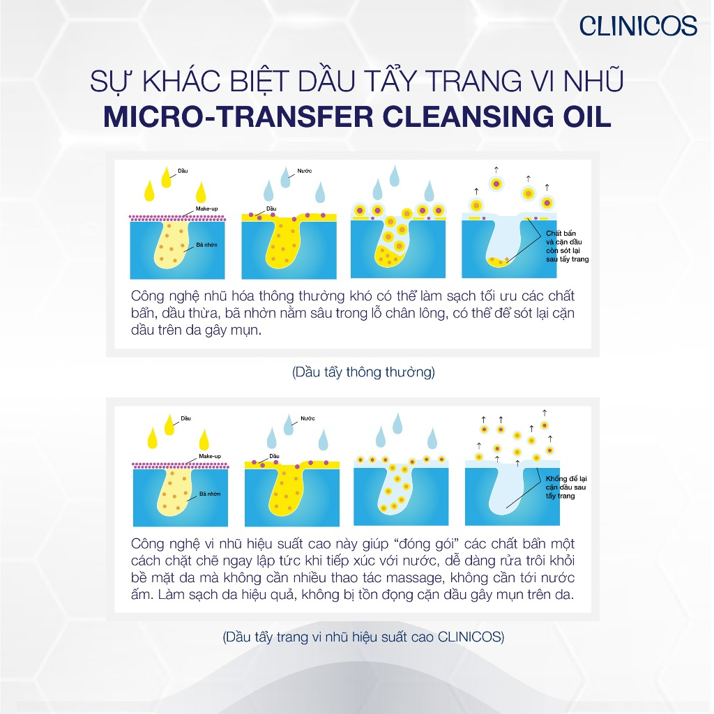 Dầu Tẩy Trang Clinicos Micro - Transfer Cleasing Oil Vi Nhũ 150ml