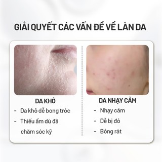 Mặt Nạ B5 Cấp Ẩm Phục Hồi Làm Dịu Da Arocell Hyal B5 Soothing Mask | Hộp 10 Miếng