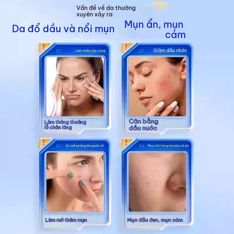 Gel Finacea 15% Azelaic Acid 30g/giảm mụn đỏ và dầu nhờn