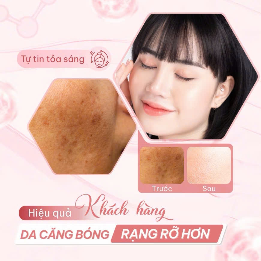 Serum Compliment Anti-wrinkle Niacinamide, VitaminC & Tranexamic Acid Kiềm Dầu, Sáng Da Đều Màu 27ml | BigBuy360 - bigbuy360.vn