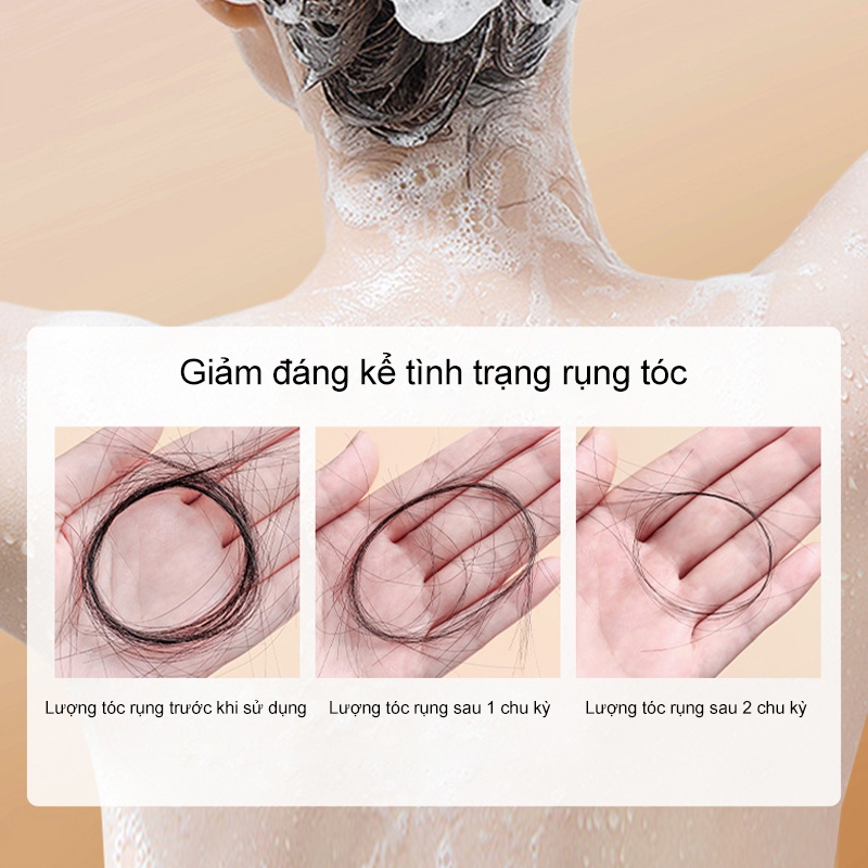 Dầu gội chống rụng tóc MALGOOLE, dầu gội chống rụng tóc, giảm rụng tóc và rụng tóc, kiểm soát dầu và chống gàu 400ml