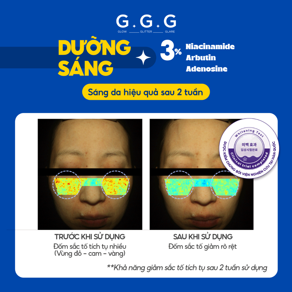 [HÀNG TẶNG] Mặt Nạ Hạ Nhiệt GGG - Làm Dịu Da Ửng Đỏ, Dưỡng Trắng Sáng & Mờ Thâm Sạm G.G.G Cooling Mask 10g