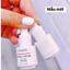 Serum Mụn Lumos Acne USA 5ml, Giúp Ngăn Ngừa Và Làm Se Khô Nhanh Các Nốt Mụn Trên Da