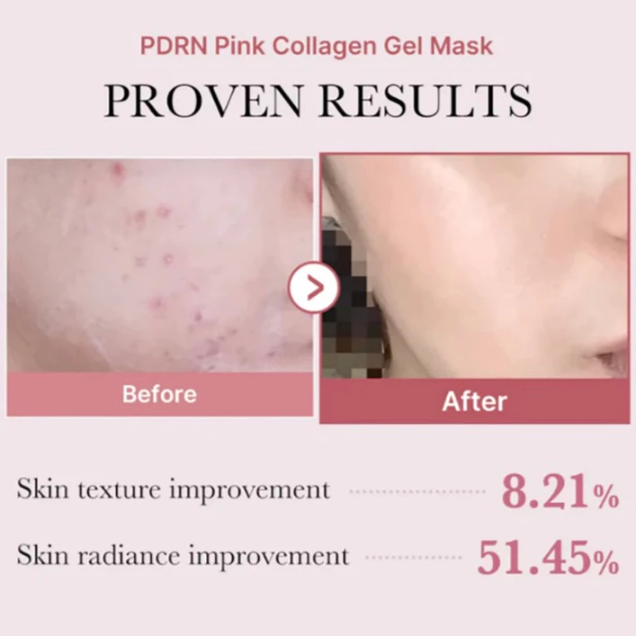 Medicube PDRN Pink Collagen Jelly Gel Mask 4 pcs 28g/Medicube Kojic Acid Turmeric Brightening Gel Mask 4 pcs 28g