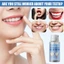 Vật Liệu Tạo Hình Tạm Thời Cho Răng EELHOE 10ml - An Toàn, Dễ Dùng & Tiện Lợi