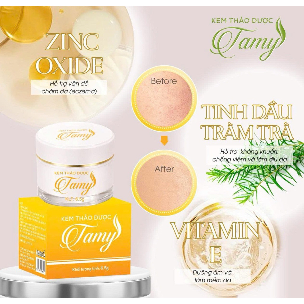 Kem Thảo Dược Bôi Da Tamy Chính Hãng Dùng Cho Mọi Lứa Tuổi