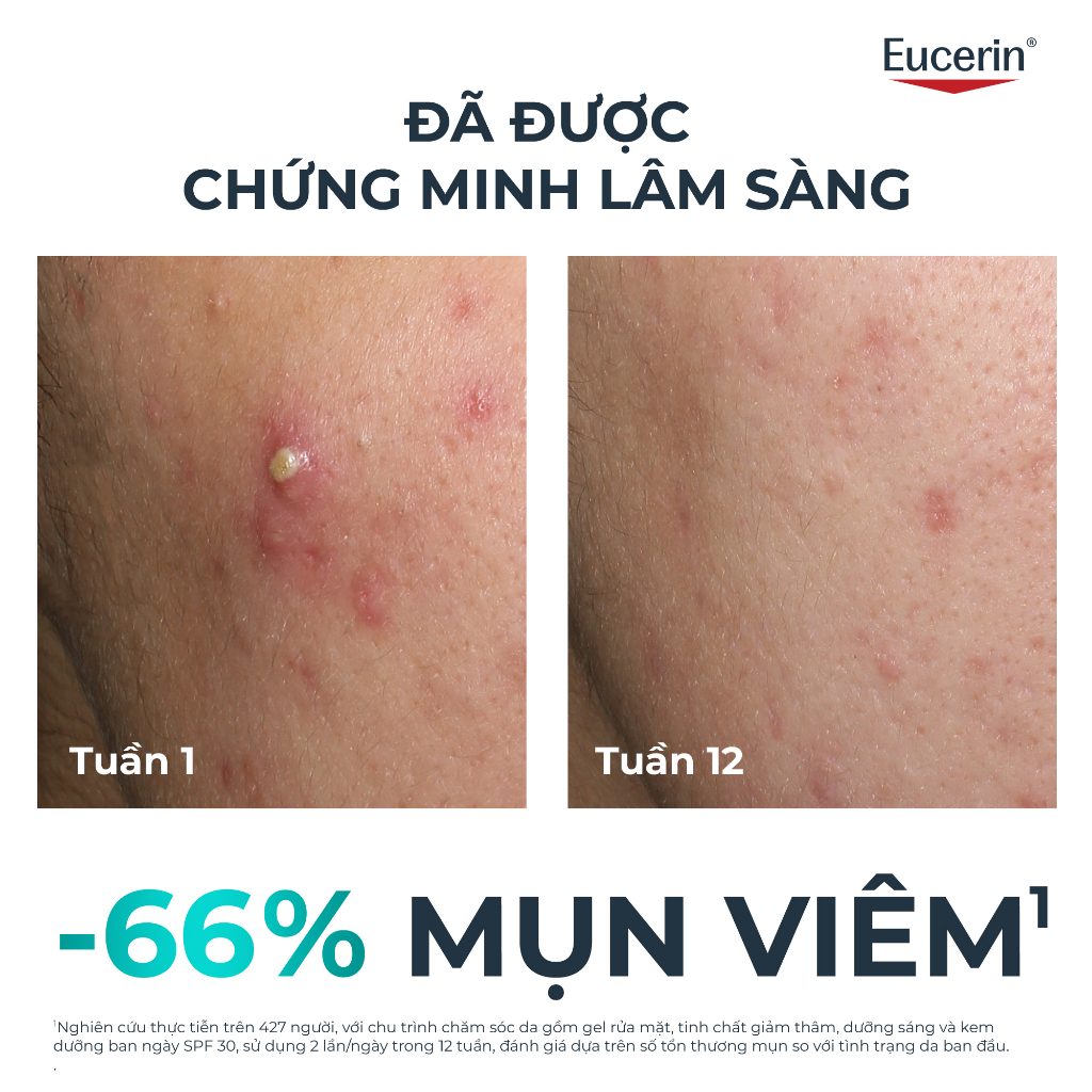 Serum Eucerin Dermopure Clinical Triple Action Giảm Thâm Mụn & Sáng Da 40ml