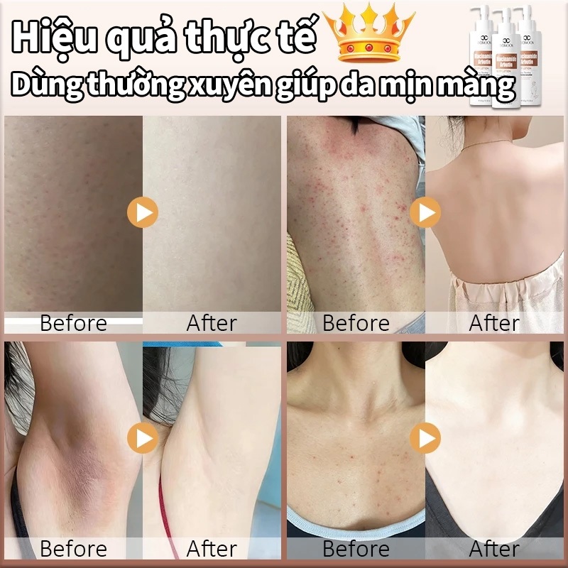 Sữa dưỡng thể Niacinamide Arbutin LYDIMOON 300g Kết cấu nhẹ thấm nhanh không nhờn dưỡng ẩm làm trắng mịn hết thô ráp