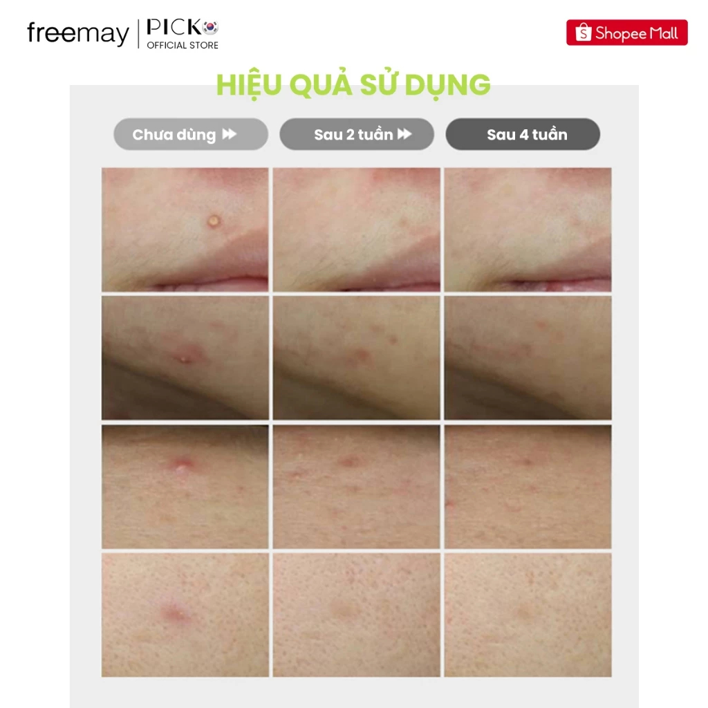 [QUÀ TẶNG KHÔNG BÁN] Combo minisize Freemay gồm 1 chai Toner thuần chay 100ml và 1 chai Kem Dưỡng phục hồi 30ml
