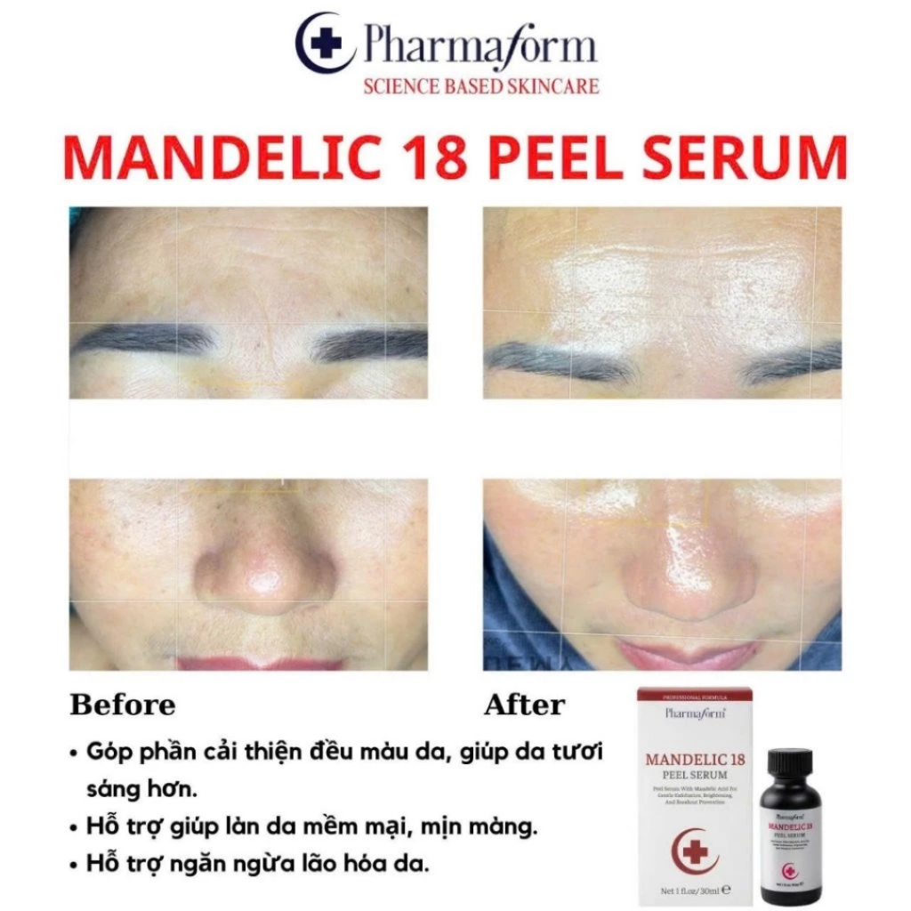 Tinh chất Serum Peel Căng Bóng Mandelic 18 Pharmaform Hỗ Trợ Tẩy Da  Chết,Dưỡng Sáng - Rosia Cosmetic | Shopee Việt Nam