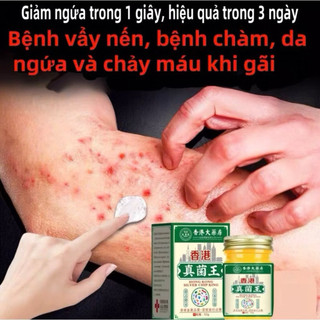 Kem Thảo Dược Kháng Khuẩn Chăm Sóc Da Hỗ Trợ Làm Dịu Da Ngứa, Da Khô Ráp, Chăm Sóc Da Hằng Ngày Hiệu Quả