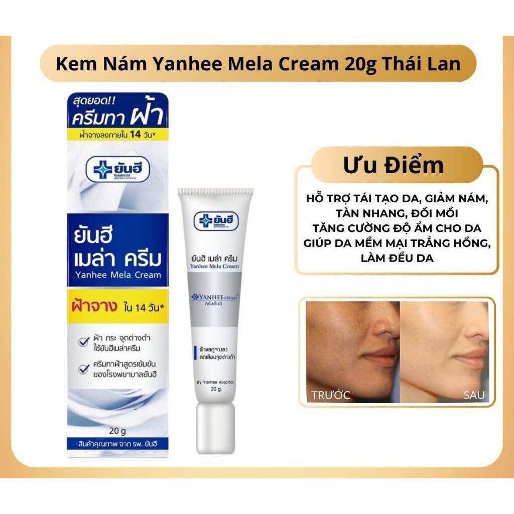 Kem Nám Tàn Nhang YANHEE Weilaiya Cao Cấp Mờ Nám Tàn Nhang Đồi Mồi Dưỡng Ẩm Da, Phục Hồi Chống Lão Hóa Da