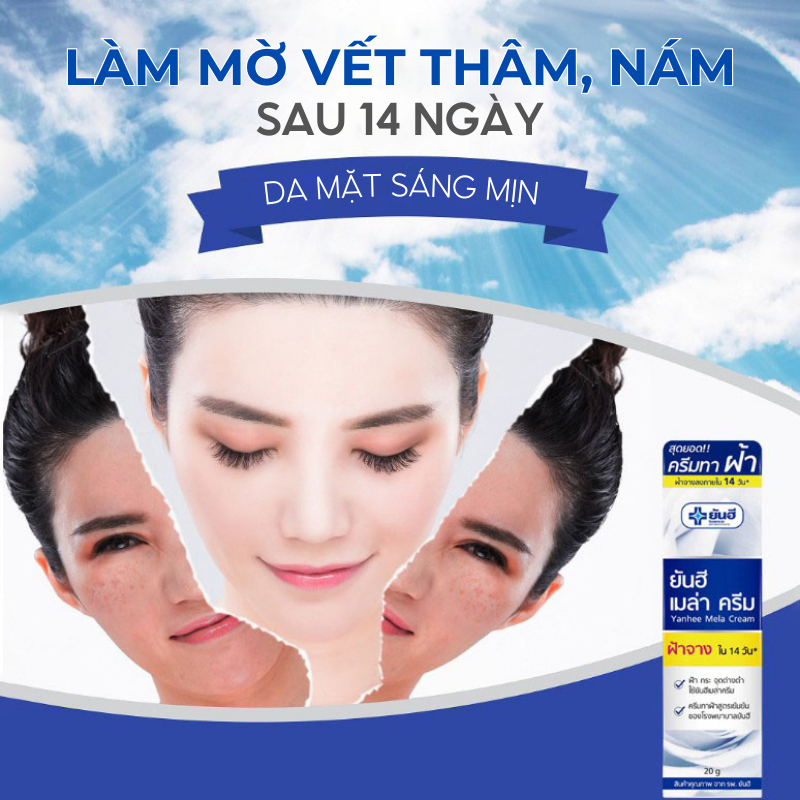 Kem Nám Tàn Nhang YANHEE Weilaiya Cao Cấp Mờ Nám Tàn Nhang Đồi Mồi Dưỡng Ẩm Da, Phục Hồi Chống Lão Hóa Da