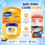 Sáp Dưỡng Môi Mềm Mịn Vaseline 7g Lip Therapy