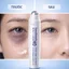 Thanh Lăn Giảm Thâm Quầng Mắt, Xóa Bọng Mắt Compliment Eye 11ml của Nga