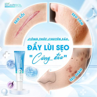 Kem Dizigone Scarsol: Kem mờ thâm sẹo, làm đều màu da, phục hồi da - Tuýp 15g