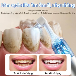 kawu Máy làm sạch răng bằng sóng siêu âm sạc lại được đầu silicon y tế máy cạo vôi răng tại nhà