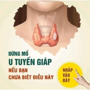 liệu trình tiêu u hạch 2kg