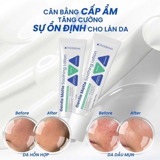 Kem dưỡng ẩm da dầu mụn hỗ trợ làm khỏe và ổn định làn da Trioderma Gentle Matte Soothing Lotion 40g