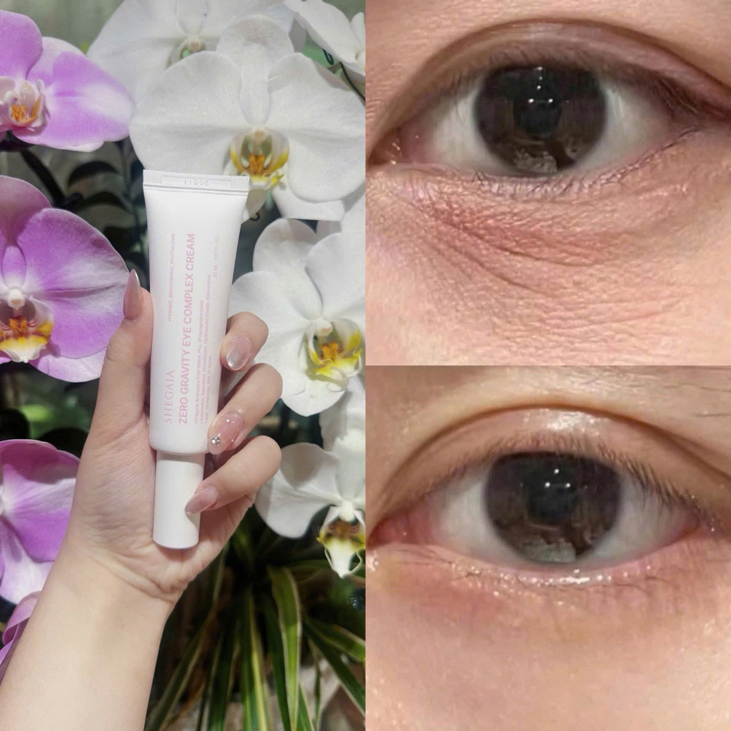 ĐMN) Shegaia - Zero Gravity Eye Complex Cream Giảm bọng mắt, mờ
