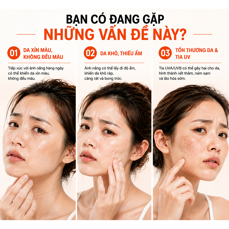 LYDIMOON Sữa dưỡng thể Niacinamide, Dưỡng sáng, cấp ẩm, chống nắng SPF 30, làm mềm mịn toàn thân, mượt như lụa 100g