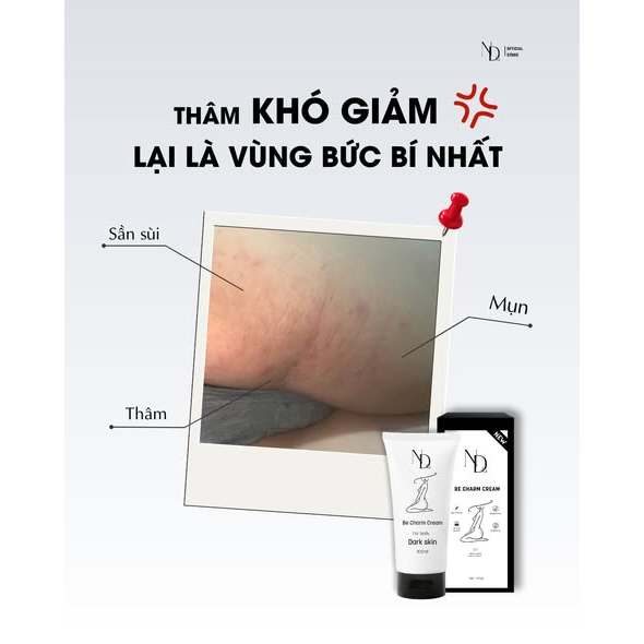 Kem Giúp Giảm Thâm v3, nhũ hoa, nách,... Body Be Charm