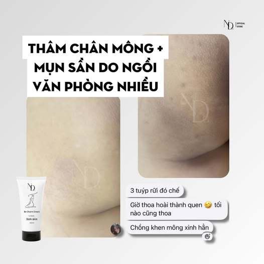 Kem Giúp Giảm Thâm v3, nhũ hoa, nách,... Body Be Charm
