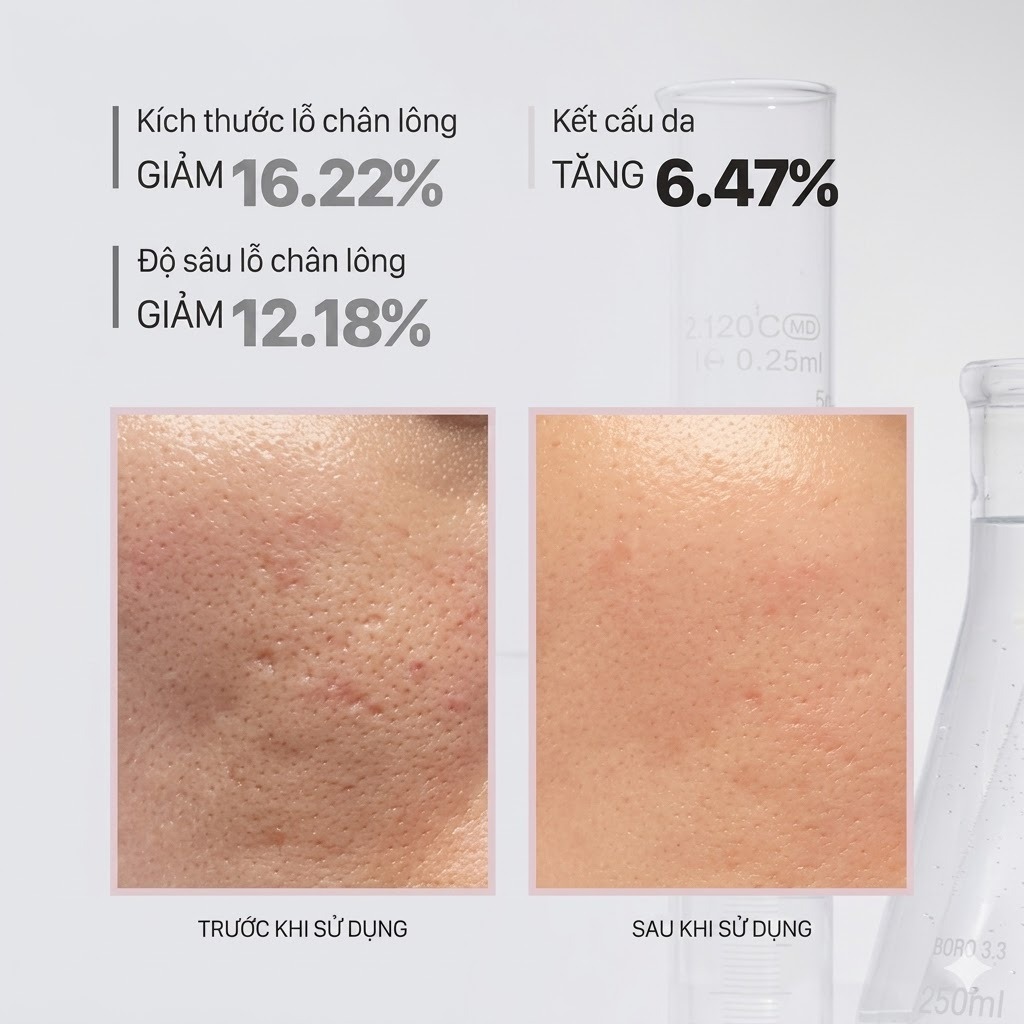 [Top 1 bán chạy] Lọ Peel tẩy da chết tái tạo da chuyên sâu CNP Rx Skin Rejuvenating Intensive Peel 5ml - AB Authentic | BigBuy360 - bigbuy360.vn