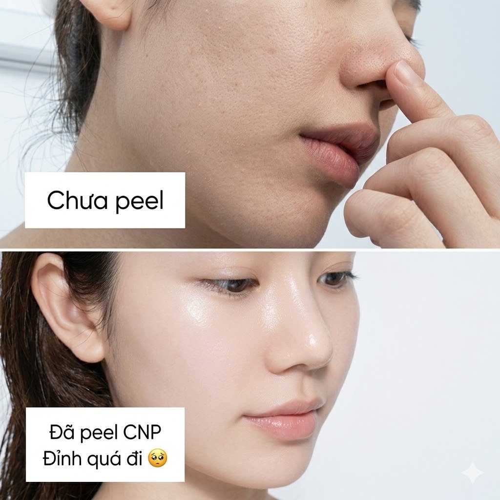 [Top 1 bán chạy] Lọ Peel tẩy da chết tái tạo da chuyên sâu CNP Rx Skin Rejuvenating Intensive Peel 5ml - AB Authentic | BigBuy360 - bigbuy360.vn