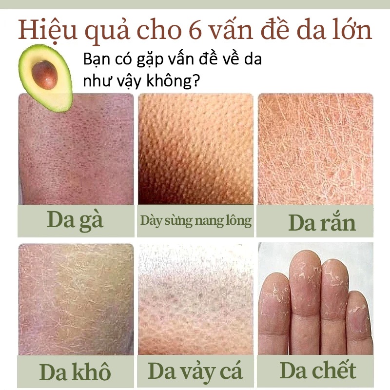 Kem Tẩy Tế Bào Chết Body, Làm Sạch Da Chết, Mịn Da, Giảm Da Sần Da Gà, Làm Sáng Da, Vitamin E LYDIMOON, 250g