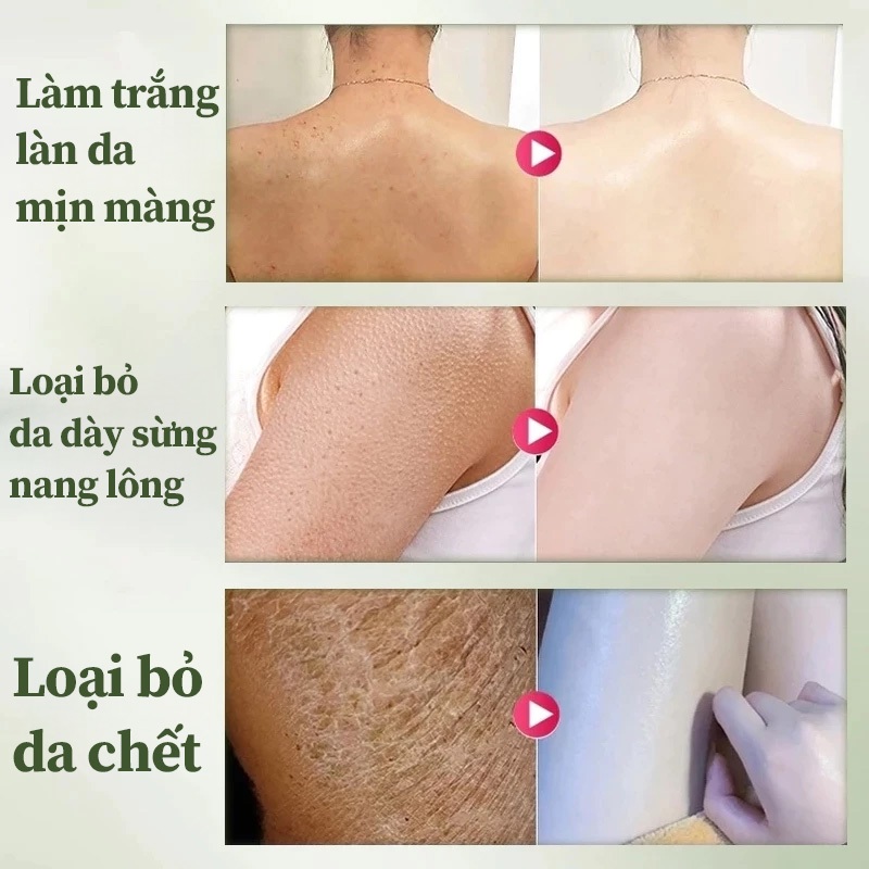 Kem Tẩy Tế Bào Chết Body, Làm Sạch Da Chết, Mịn Da, Giảm Da Sần Da Gà, Làm Sáng Da, Vitamin E LYDIMOON, 250g