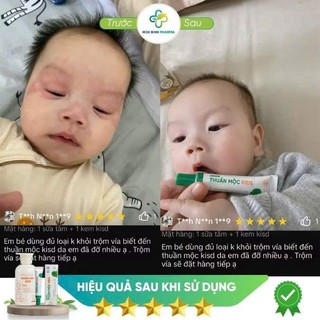 Kem bôi da Thuần Mộc Kids - làm dịu rôm sảy, mẩn ngứa, chàm sữa chăm sóc da bé iu