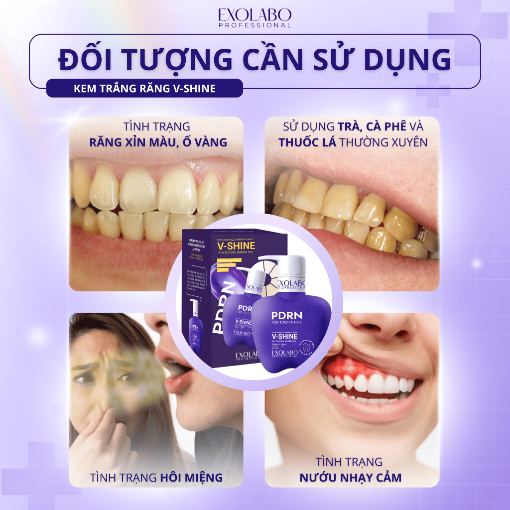 [ EXOLABO ] COMBO 2 Kem Đánh Răng V-SHINE, GIÚP RĂNG TRẮNG SÁNG – LÀM SẠCH MẢNG BÁM