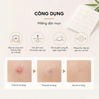 Miếng Dán Mụn Axit Salicylic, Tinh Chất Dầu Cây Trà, Che Khuyết Điểm Vô Hình Chăm Sóc Da Mặt.