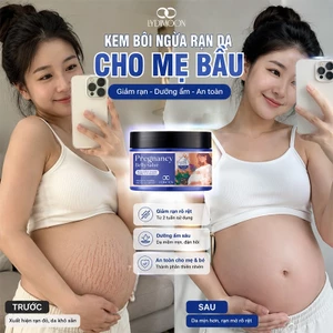kem rạn da cho bà bầu 120g chiết xuất thiên nhiên bơ hạt mỡ dầu dừa giảm thâm mờ sẹo phục hồi da chống rạn hiệu quả