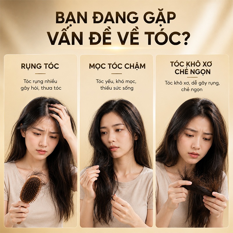 Dầu gội chống rụng tóc MALGOOLE, dầu gội chống rụng tóc, giảm rụng tóc và rụng tóc, kiểm soát dầu và chống gàu 400ml