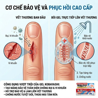 Urgo Dạng Gel Bôi Vết Thương Kobayashi 10g Tái Tạo Vết Thương Trong 24h An Toàn Cho Mọi Loại Da SK15