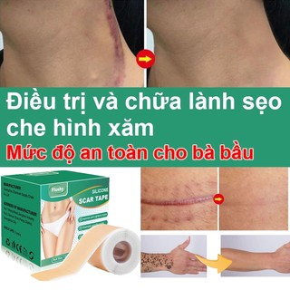 Tấm Dán Mờ Sẹo Lồi/ Sẹo Thâm/ Sẹo Phẫu thuật giữ ẩm làm lành vết thương, hạn chế thâm sẹo 4cm x 150cm miếng dán che sẹo