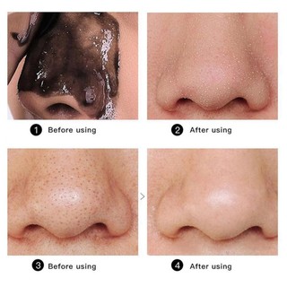 Mặt Nạ Đẩy Mụn Đầu Đen Mặt Nạ Lột Mụn Loại Bỏ Mụn Đầu Đen Cải Thiện Vấn Đề Mụn (60g)