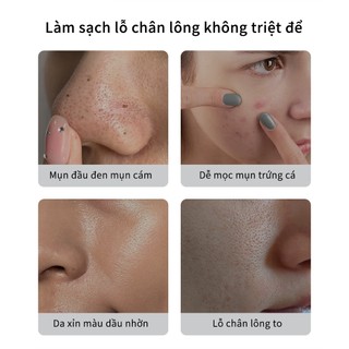 Mặt Nạ Đẩy Mụn Đầu Đen Mặt Nạ Lột Mụn Loại Bỏ Mụn Đầu Đen Cải Thiện Vấn Đề Mụn (60g)