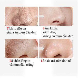 Mặt Nạ Đẩy Mụn Đầu Đen Mặt Nạ Lột Mụn Loại Bỏ Mụn Đầu Đen Cải Thiện Vấn Đề Mụn (60g)