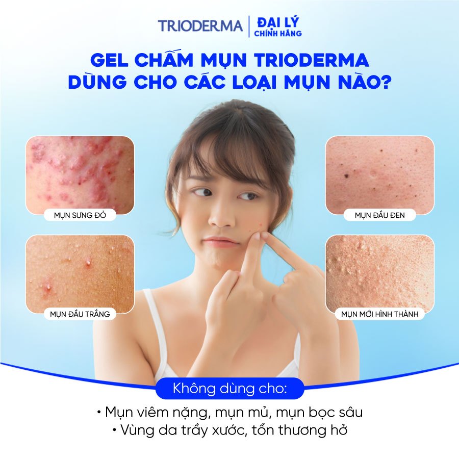 Combo 2 kem chấm mụn Trioderma Anti Acne Gel mờ thâm giảm mụn, làm dịu da 15g