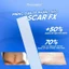 Miếng Dán Sẹo Lồi / Phì Đại REJUVASKIN Scar FX