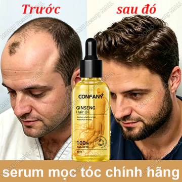 Tinh chất mọc tóc serum mọc tóc chính hãng thuốc mọc tóc cho nam và nữ kích thích mọc tóc Ngăn ngừa rụng tóc