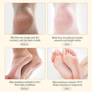 Kem Dưỡng Gót Chân Giảm Nứt Gót Chân Chai Sần Dưỡng Da Chân Và Tay Mềm Mịn SADOER Bơ Hạt Mỡ 60G  Nứt Gót Chân Dưỡng Ẩm