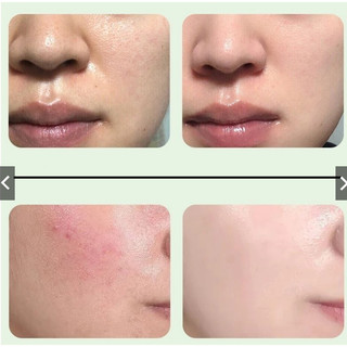 Tẩy tế bào chết Nha đam GINBI -- Tẩy da chết GINBI -mềm mịn da