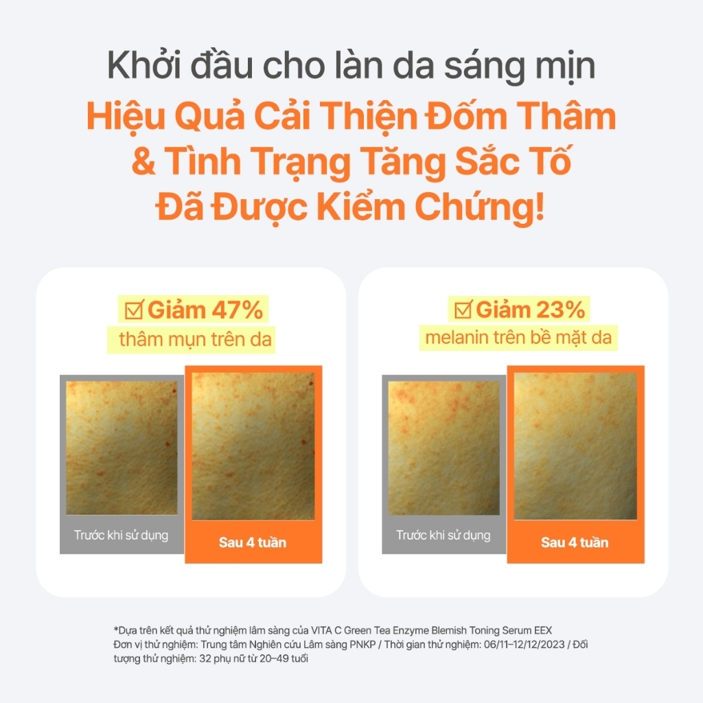 INNISFREE x Serum Vitamin C sáng da, mờ thâm mụn INNISFREE Green Tea Enzyme Brightening Serum 30ml