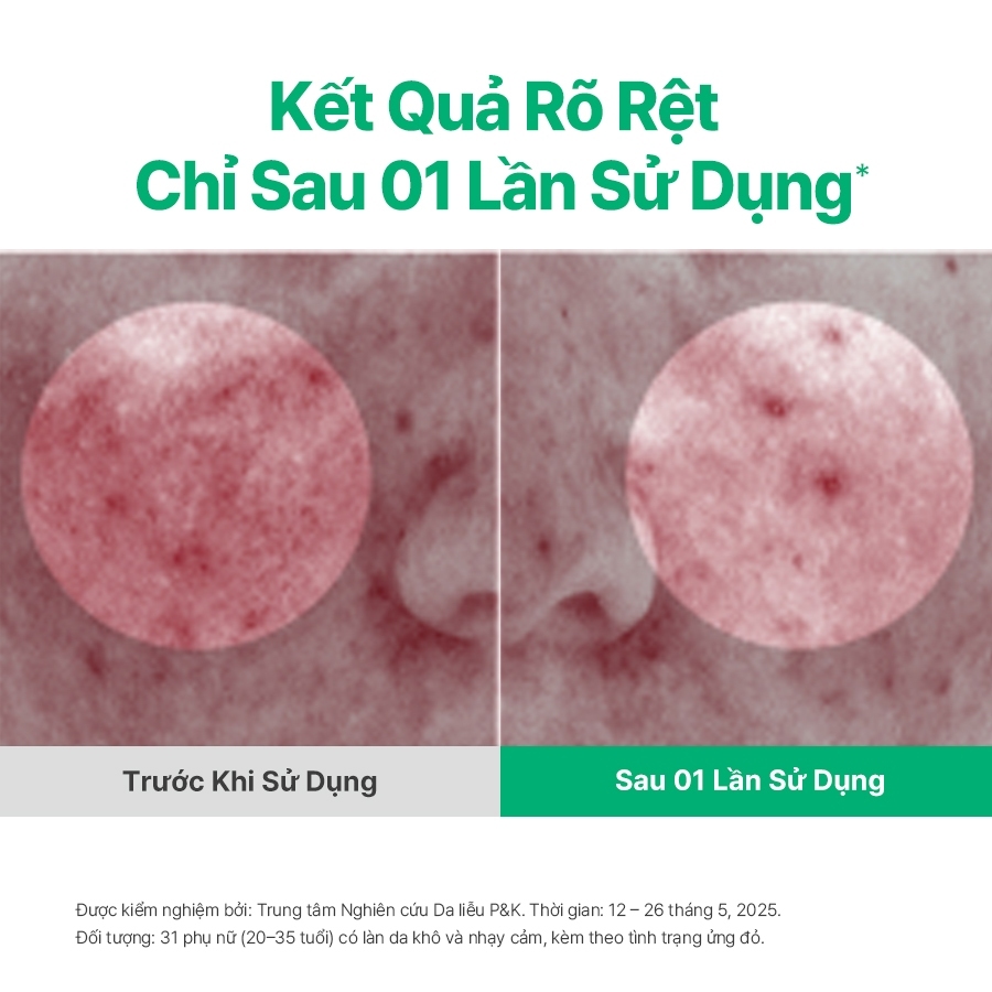 INNISFREE x Kem dưỡng cấp ẩm, phục hồi INNISFREE Green Tea Ceramide Cream 50ML